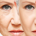 What age do you start aging rapidly?