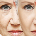 Can aging skin be improved?