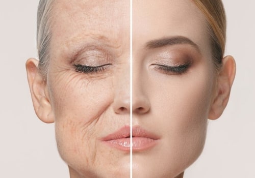 Is skin aging reversible?